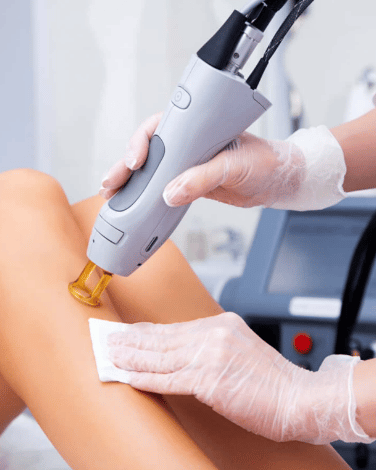 Bent legs for laser hair removal
